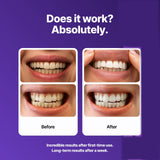 Dr Dent Teeth Whitening Strips